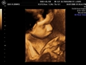 3rd Term Week 28 4D Ultrasound